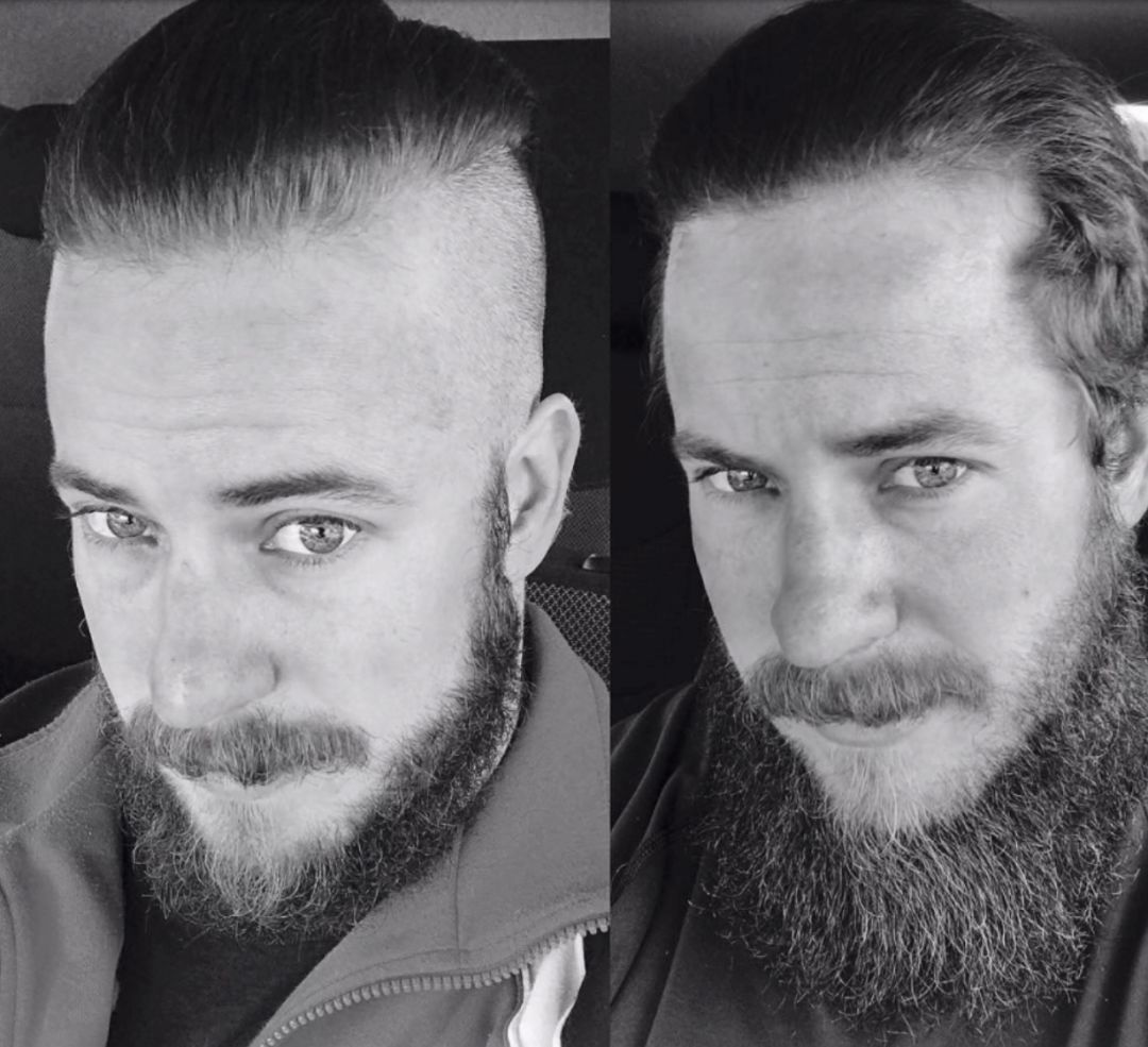 防脱而且还生发的洗发水,一款可以从根本改善发质的洗发水