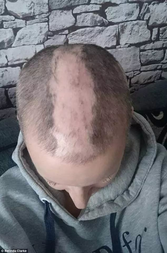 防脱而且还生发的洗发水,一款可以从根本改善发质的洗发水