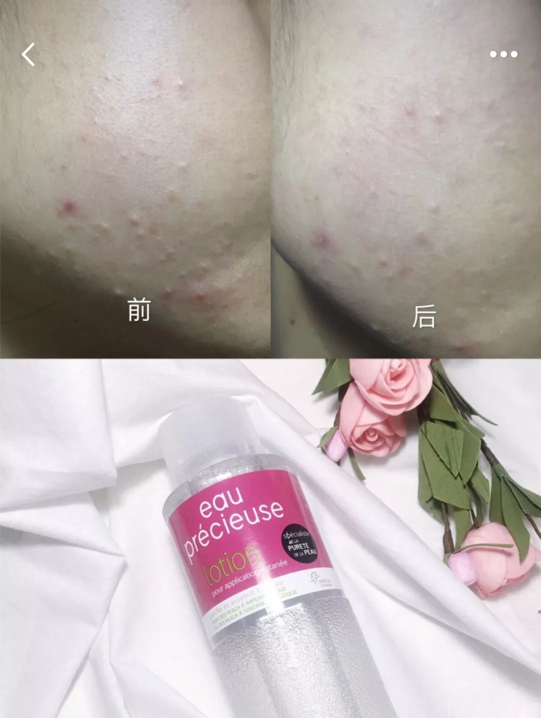 摸着良心推荐书籍,告别大红脸拯救痘痘肌