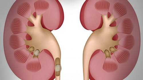 尿结石止痛按哪个穴位,尿结石肚子疼怎么止痛