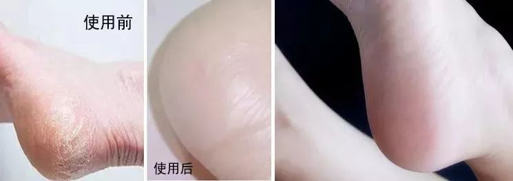 足底暖宝宝暖身贴,冬天必备神器暖宝宝贴