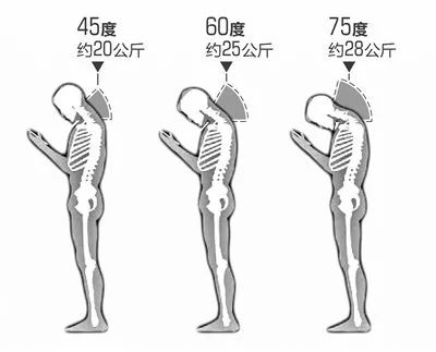颈椎僵硬劳累,颈椎僵硬肩部酸痛的有效缓解方法