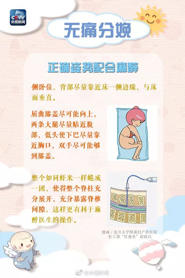 准妈妈分娩注意事项,哪些医院提供无痛分娩