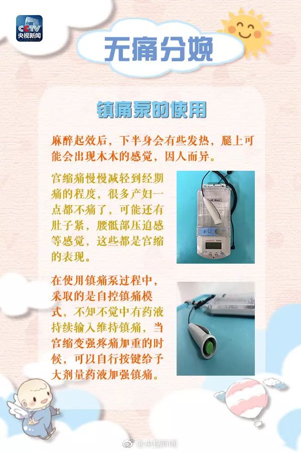 准妈妈分娩注意事项,哪些医院提供无痛分娩