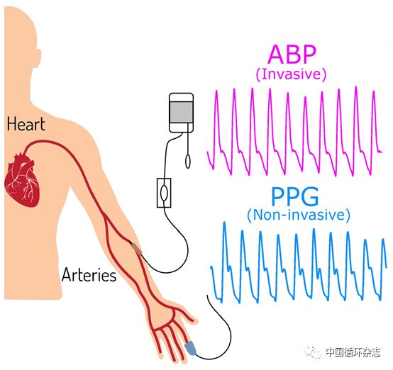 高血压有什么实时的测试设备,高血压最准确检测器