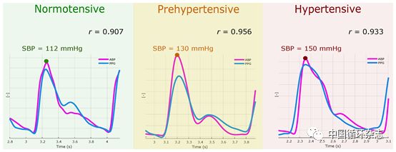 高血压有什么实时的测试设备,高血压最准确检测器