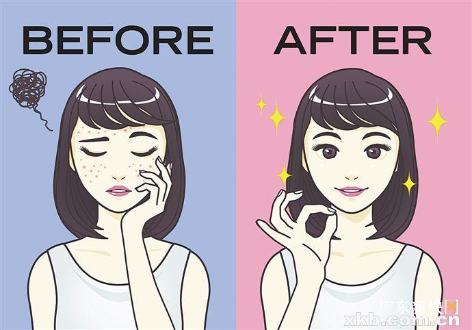 不可思议“战痘”指南：少喝牛奶多吃海鲜