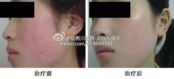 让你轻松告别色斑的困扰,告别暗沉淡化色斑