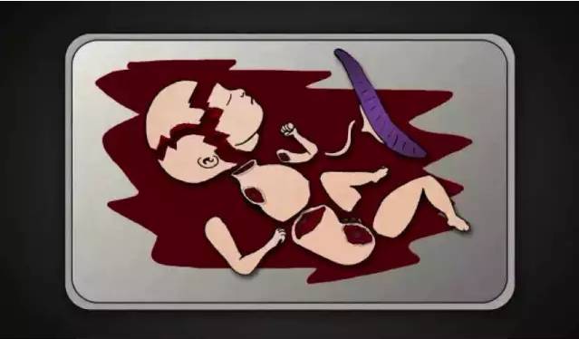 为什么一定要戴套?!情人节就要到了,为了自己,大家都看看吧……