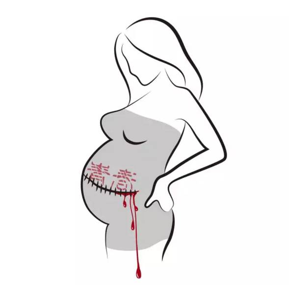 为什么一定要戴套?!情人节就要到了,为了自己,大家都看看吧……