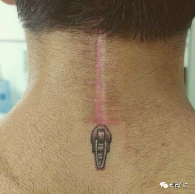 去除纹身疤痕最好的方法,疤痕纹身怎么去除