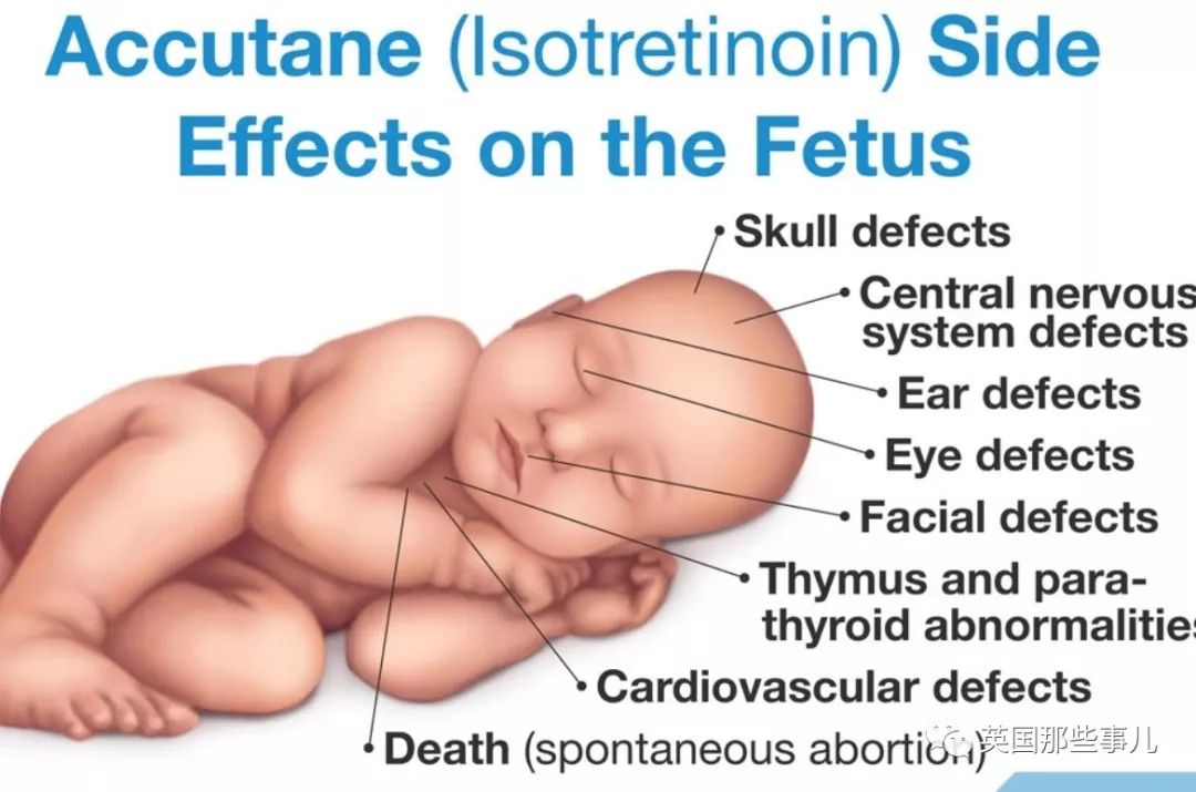 本来只想吃药治个痘,却让自己长期不举?这群英国男人无比忧桑……