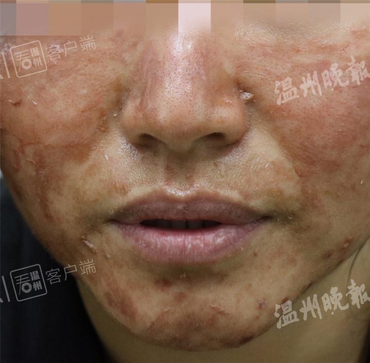 网红面膜的真实身份,被曝光的网红面膜