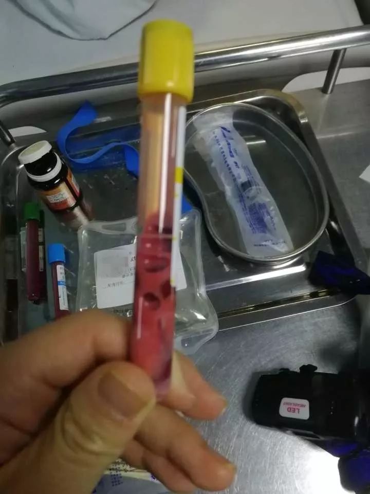 17岁少女抽出粉红色的血，瞬间凝固差点丢命！原因竟是3年前开始……