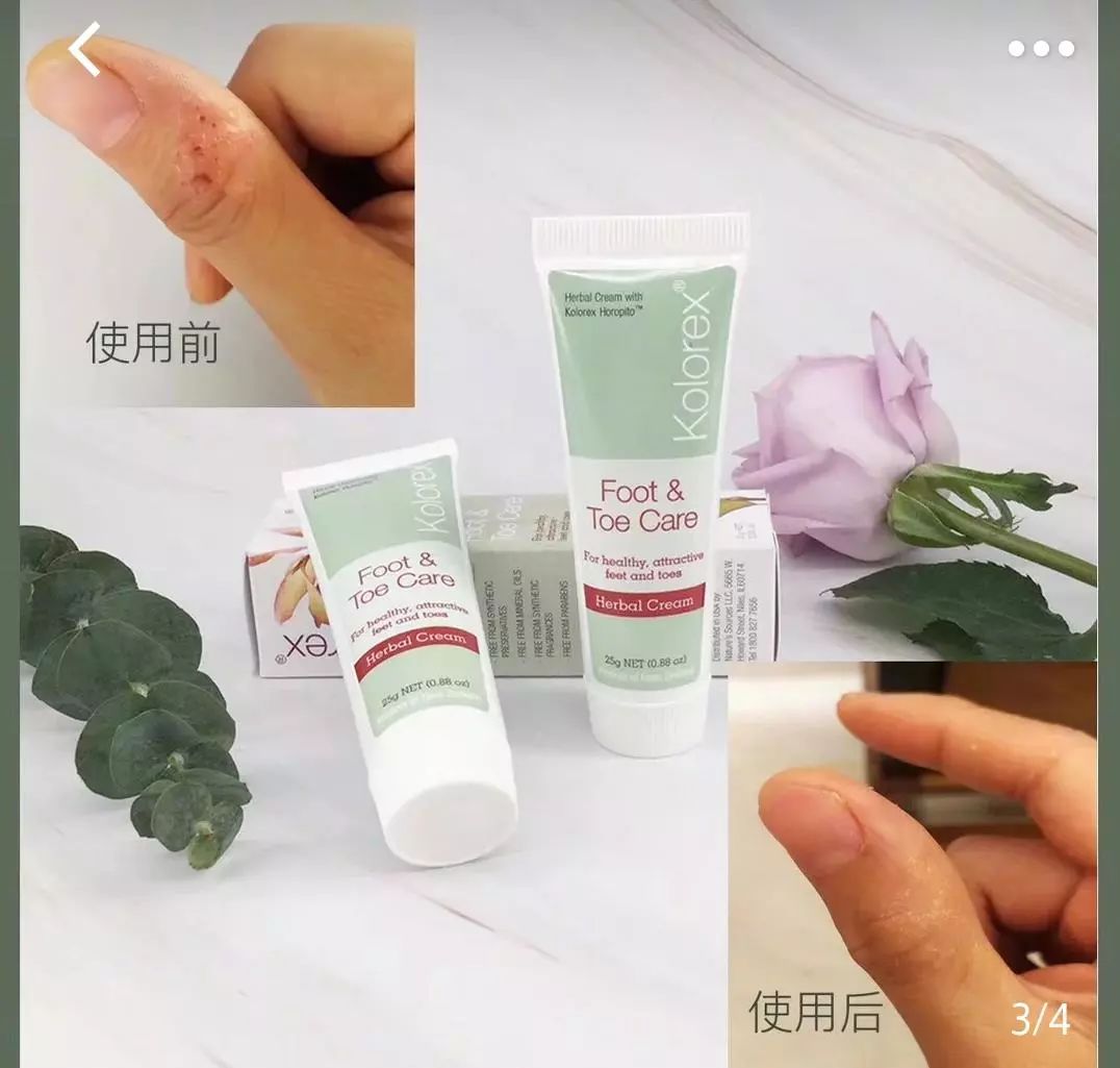 “男朋友的脚堪比生化*器武**！我得治治他！”