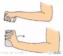 鼠标手康复科普文章,鼠标手的康复和治疗