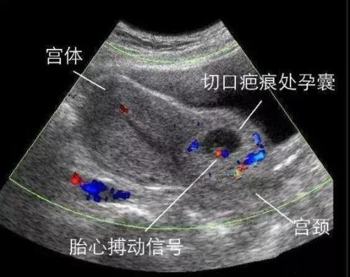 夜班惊魂大结局,夜半惊魂免费观看
