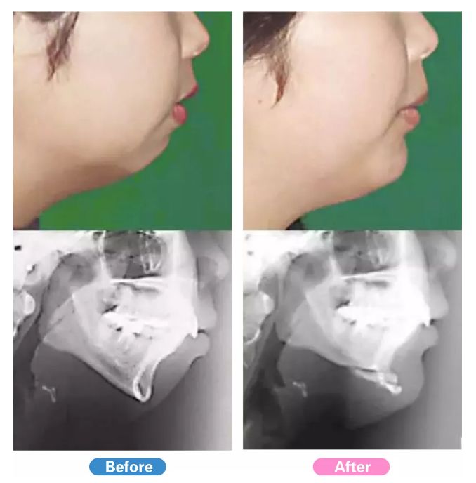 强势围观!日本最牛的一家整形医院,募集中国模特啦啦啦~