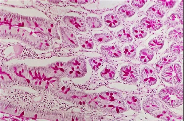 粘液和粘蛋白:它们在抑制HIV病毒时起作用吗?