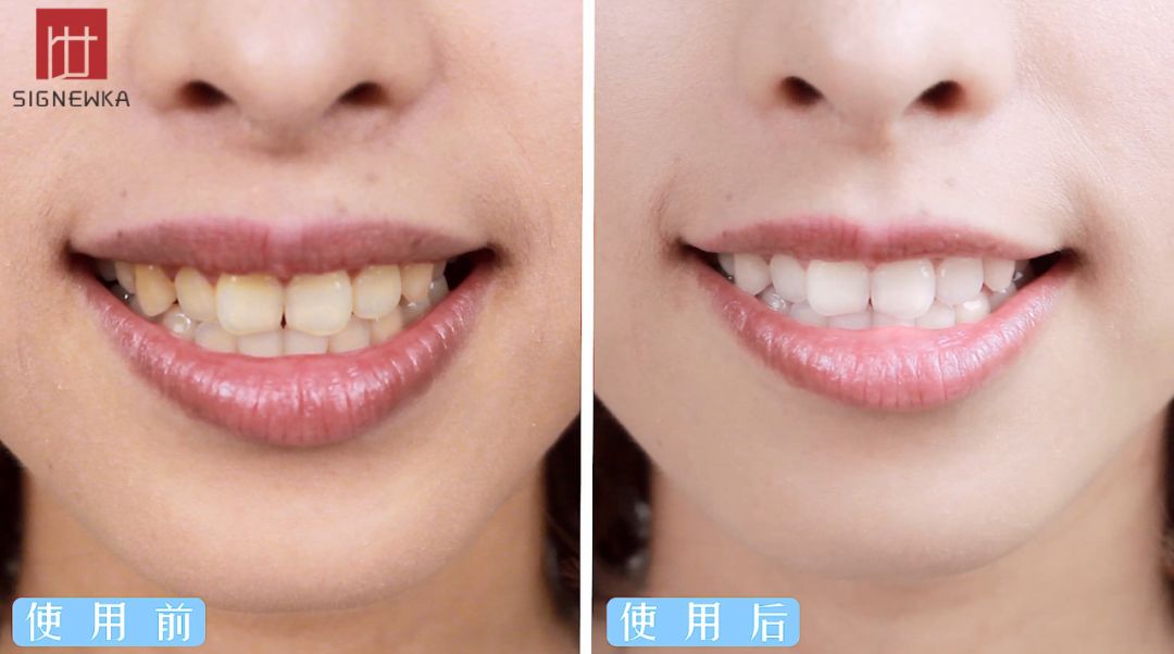 闭着嘴巴都感觉口腔有异味,闭着嘴巴嘴巴里有一股臭味