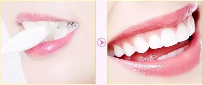 闭着嘴巴都感觉口腔有异味,闭着嘴巴嘴巴里有一股臭味