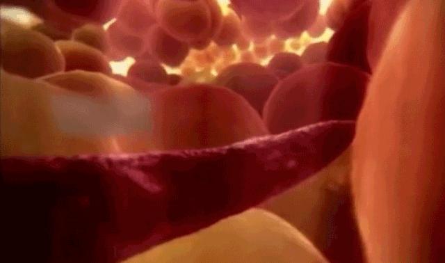 崴脚锻炼是热敷前还是热敷后,冰敷还是热敷可以化解淤血