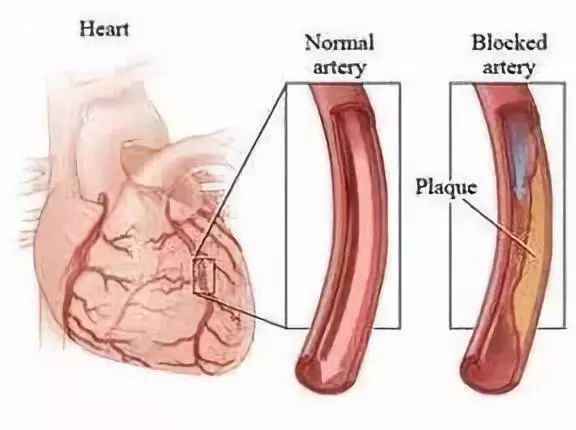 什么中药泡水喝对心血管有好处,三种中草药泡水治疗冠心病
