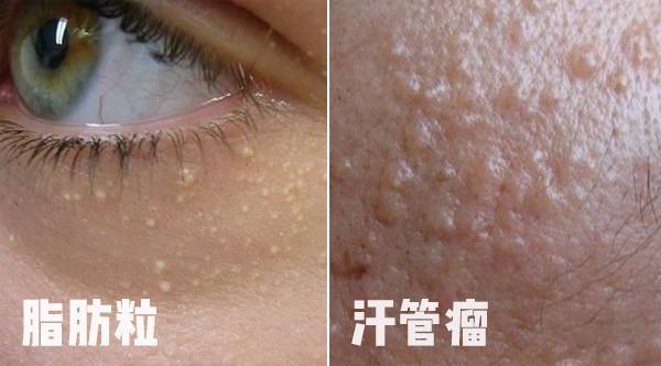 杨幂热巴奇葩造型,杨幂热巴高清图片