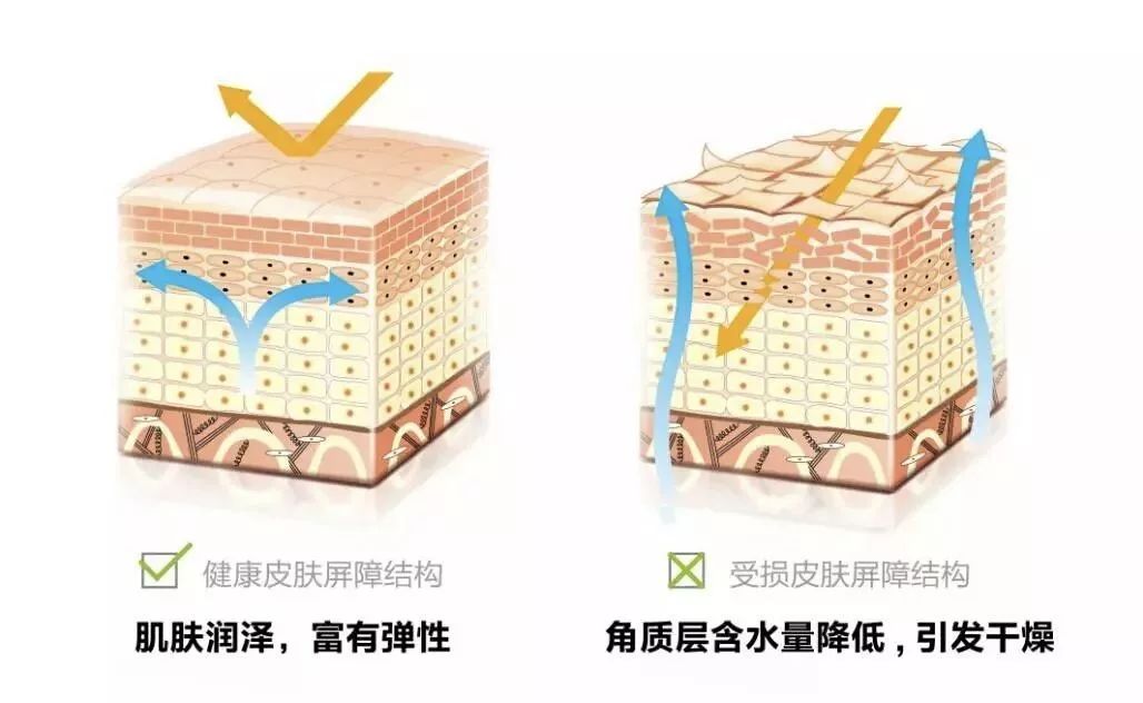 肌肤水润滋养秋冬干燥,肌肤水润嫩滑保湿护肤品