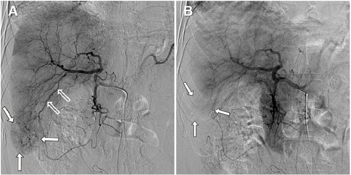 pubmed最新文献如何看全文,pubmed文献推送