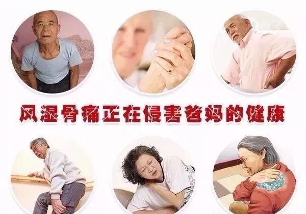 只需一招解决风湿骨病困扰,鲅鱼圈风湿骨痛