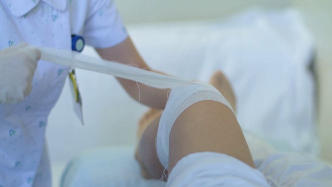 骨折如果不动手术会有什么后果,骨折以后是保守治疗好还是手术好