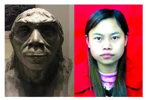 12月4日下午2点直播预告｜“嘴凸被说成猿人”到底该正畸还是做鼻子？