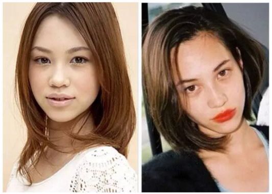 12月4日下午2点直播预告｜“嘴凸被说成猿人”到底该正畸还是做鼻子？