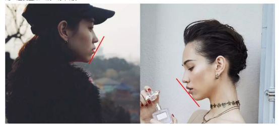 12月4日下午2点直播预告｜“嘴凸被说成猿人”到底该正畸还是做鼻子？