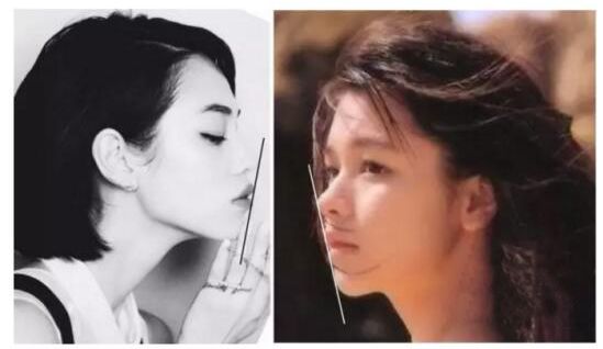 12月4日下午2点直播预告｜“嘴凸被说成猿人”到底该正畸还是做鼻子？