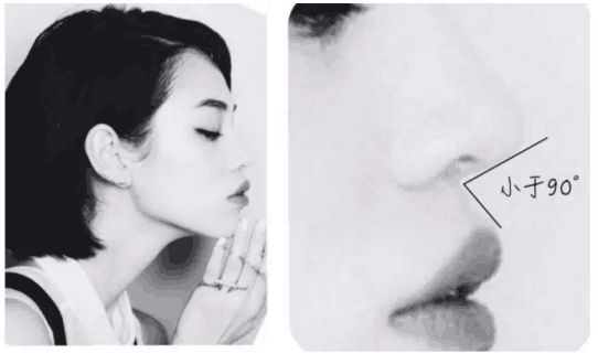 12月4日下午2点直播预告｜“嘴凸被说成猿人”到底该正畸还是做鼻子？