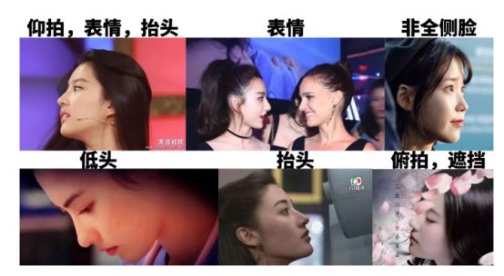 12月4日下午2点直播预告｜“嘴凸被说成猿人”到底该正畸还是做鼻子？