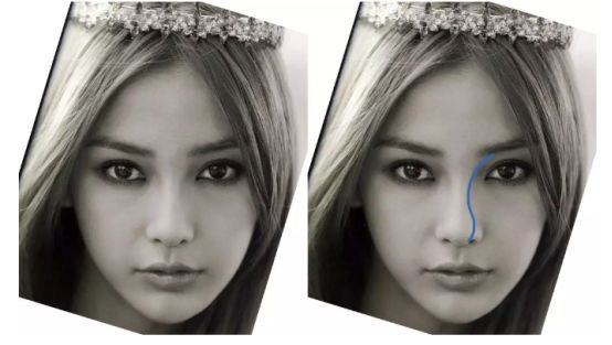 12月4日下午2点直播预告｜“嘴凸被说成猿人”到底该正畸还是做鼻子？