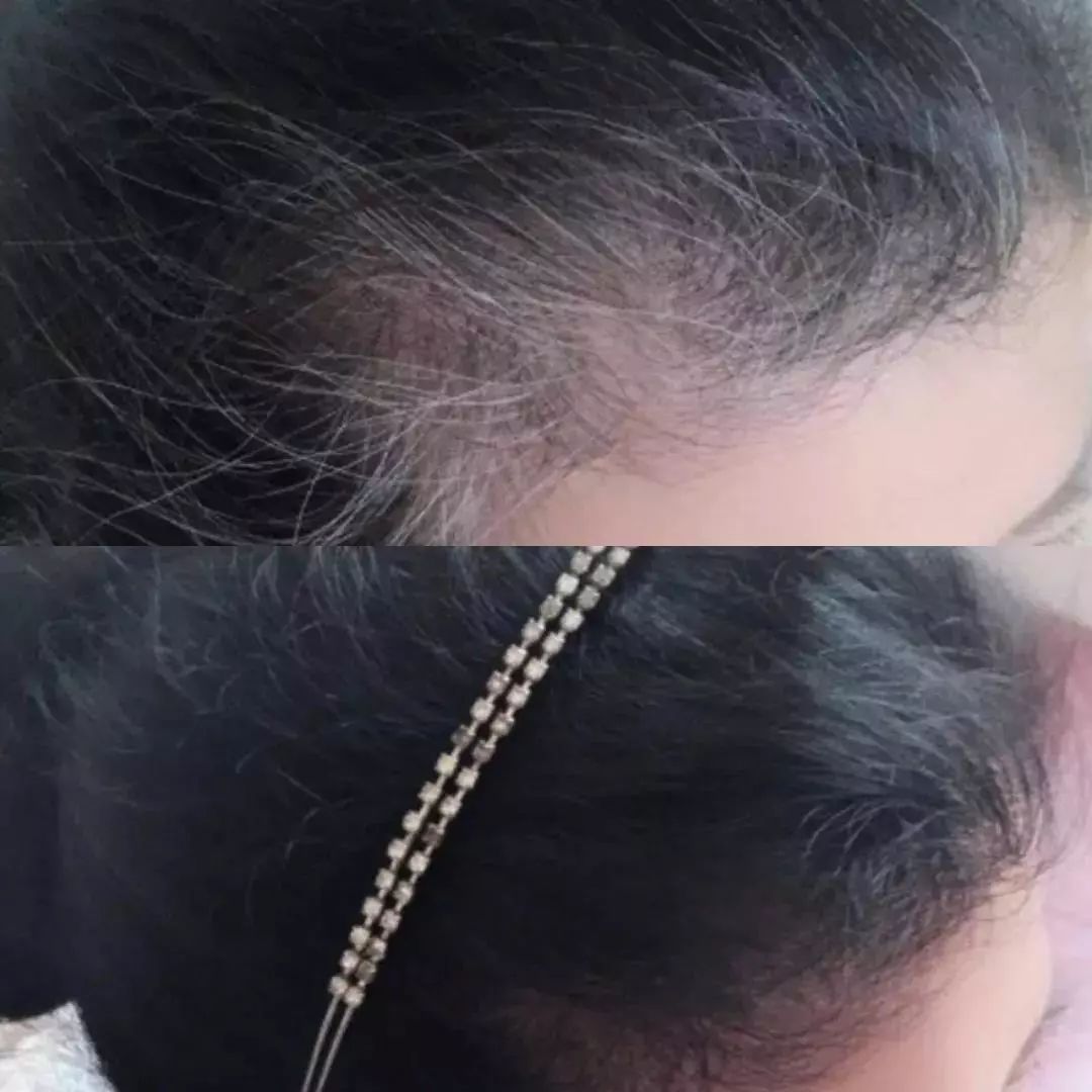 染发简单的纯植物染发剂,纯植物染发剂100%纯天然健康染发