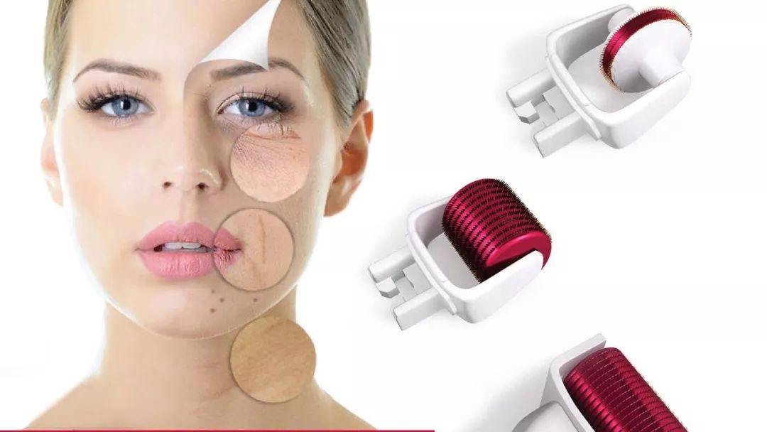 医美微针有什么效果,配合微针做的医美产品有哪些