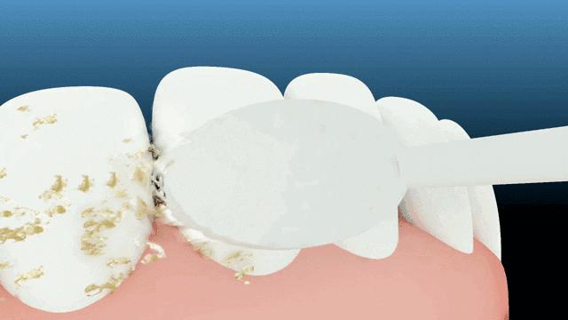 抖音卖爆电动牙刷,卖爆了的牙刷