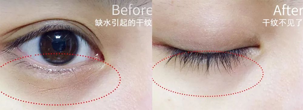 韩国品牌眼霜补水保湿,推荐一款韩国好用的眼霜