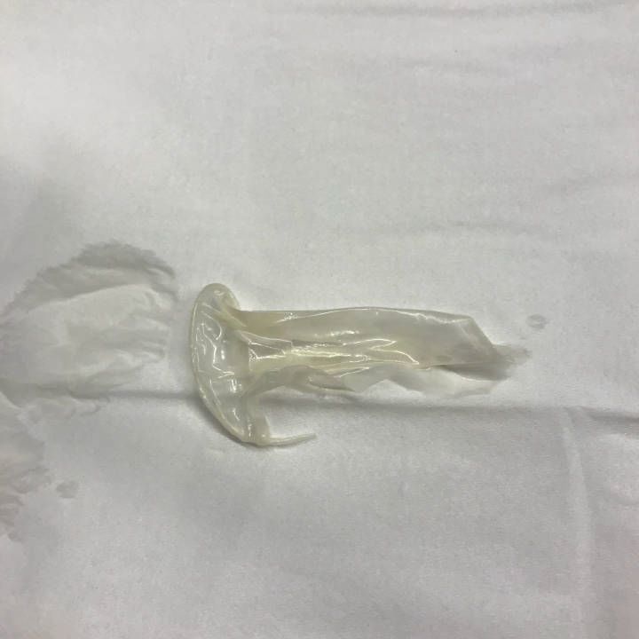 喜茶吃出异物照片,喜茶喝出石头