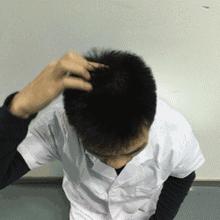 白发长在不同位置怎么治,白发长在3个部位的朋友注意了