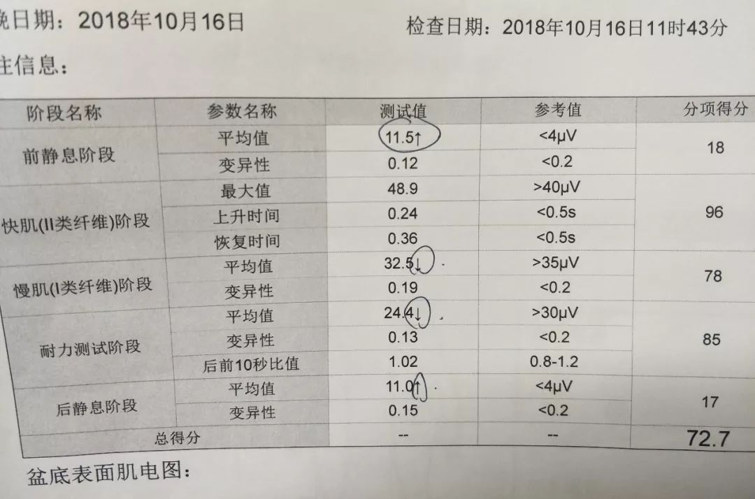 产后康复，疗效有图有真相—产后康复NO2