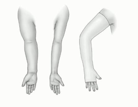 「肿瘤小课堂」乳腺癌术后胳膊肿怎么办?