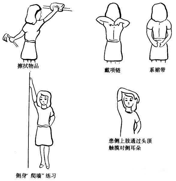 「肿瘤小课堂」乳腺癌术后胳膊肿怎么办?