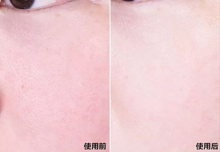 燕窝玻尿酸童颜面膜,玻尿酸燕窝面膜