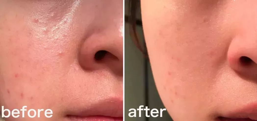 燕窝玻尿酸童颜面膜,玻尿酸燕窝面膜